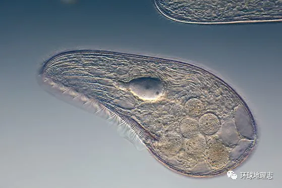 海钉螺里会有寄生虫嘛 3、单细胞生物是原核生物还是真核生物