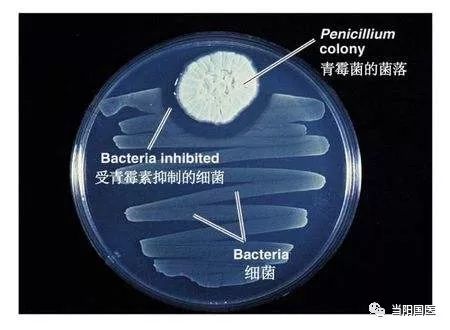 超级细菌是指? 超级细菌，我们该如何应对？